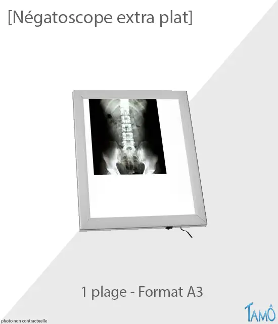 Négatoscope led extra plat 1 plage format A3