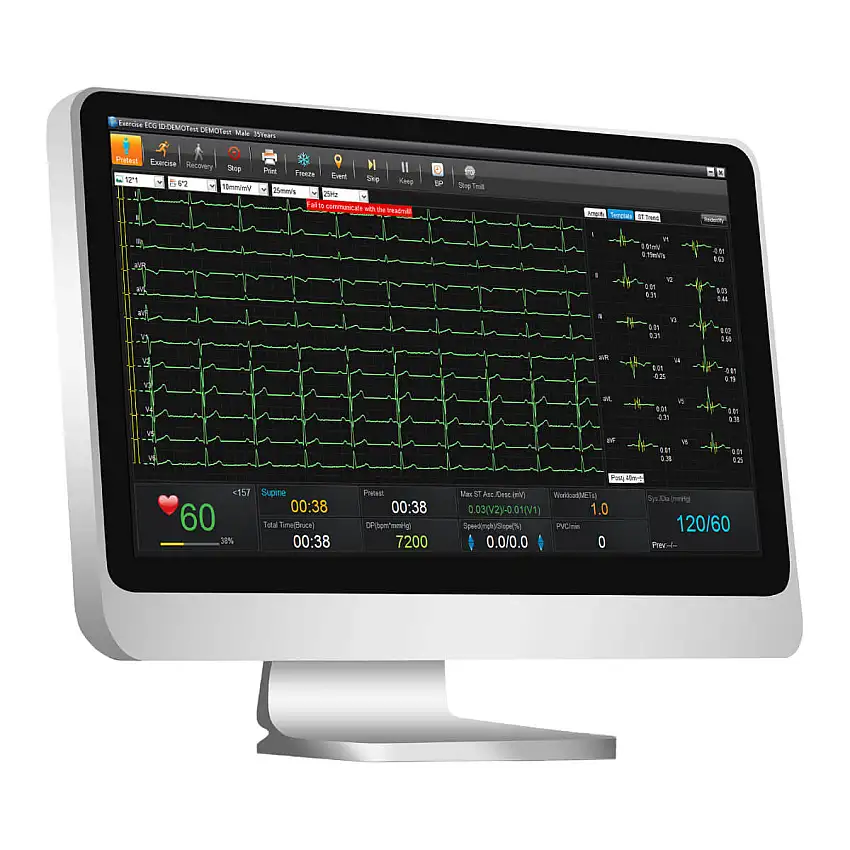 EDAN Logiciel de gestion de données ECG SE-1515 Sans collecteur de données DX12