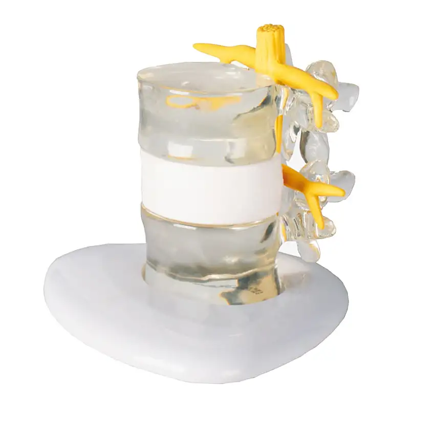 Erler-Zimmer Simulateur de hernie discale