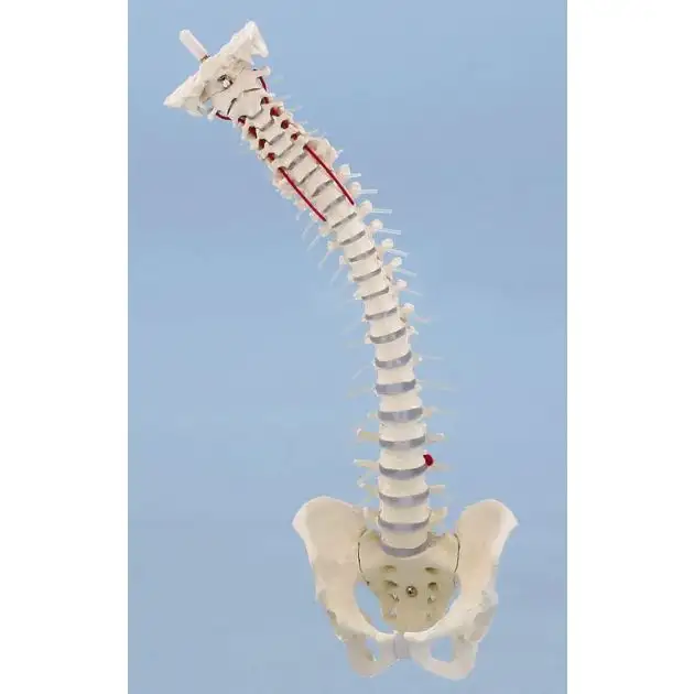 Colonne vertébrale avec hernie discale et bassin (sans support)