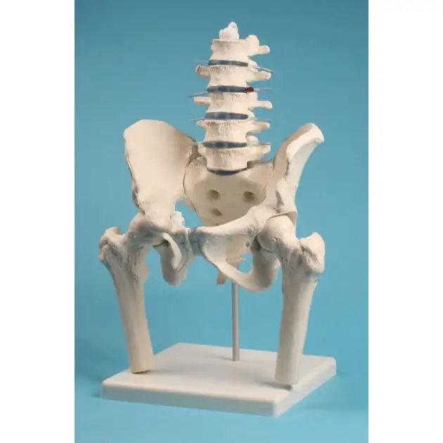 Vertèbres lombaires avec bassin et moignons fémoraux