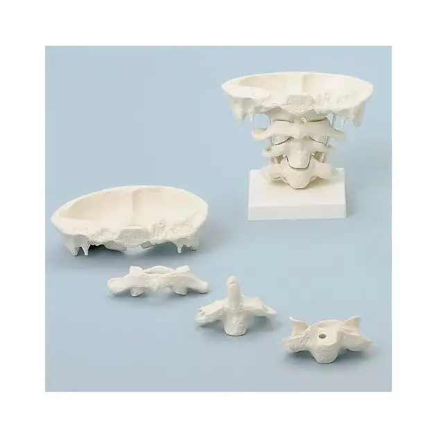 Articulation de la tête grossie (grandeur x2, avec support)