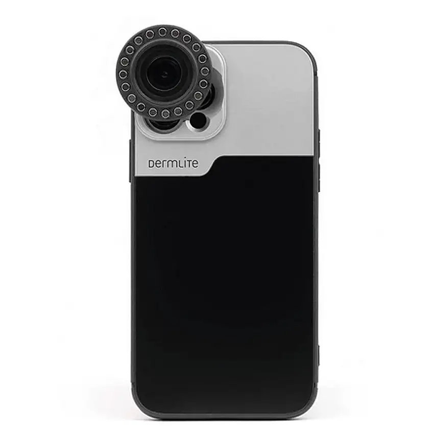 Kit de Connection DermLite pour IPhone 14 et 15 (Plus, Pro, Max) - Coque connexion IPhone 14