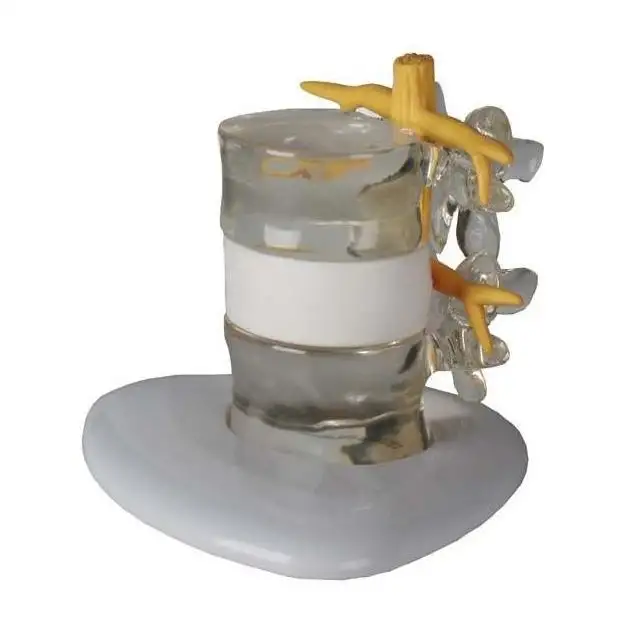 Simulateur d'hernie discale