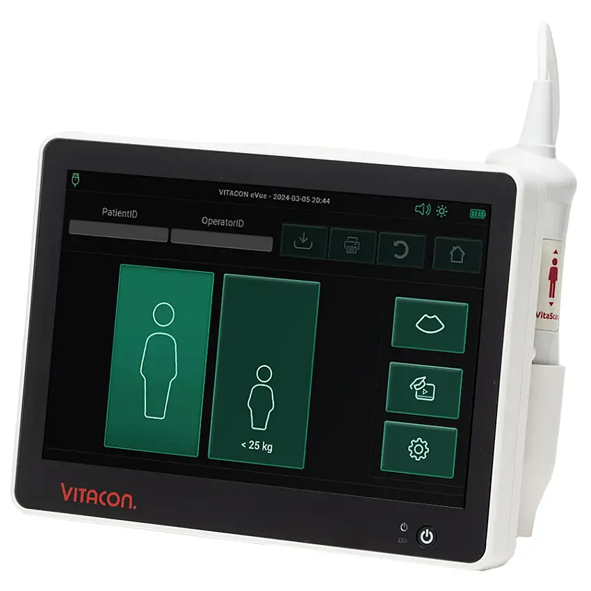 Bladder Scanner - Echographe vésical Vitascan eVue