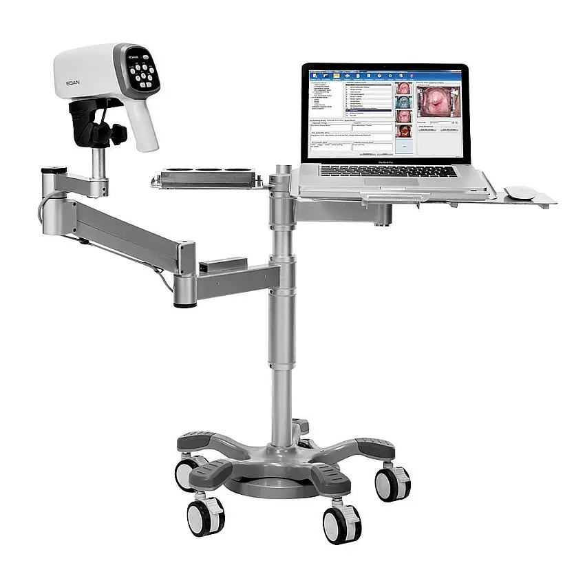 Vidéo-colposcope C6A- EDAN - Sur pied avec support PC et bras articulé