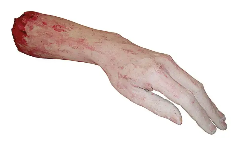 Avant-bras arraché