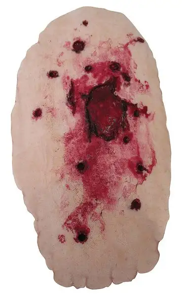 Plaie par polycriblage