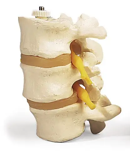 Modèle anatomique de 3 vertèbres lombaires