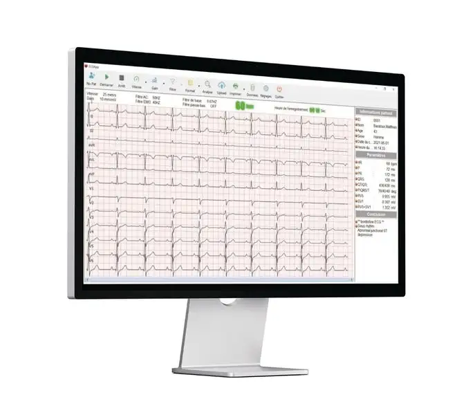 Logiciel PC pour ECG Cardiomate 3, 6 et 12 Spengler