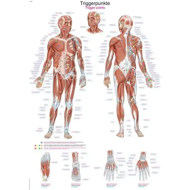 Erler Zimmer Poster Points de déclenchement 70 x 100 cm