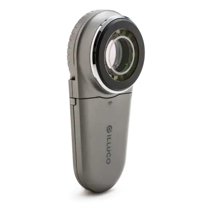 Dermatoscope Illuco usb IDS 1100