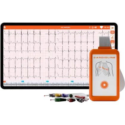 Electrocardiographe ECG Cardioline Touchecg HD+ Bluetooth (12 pistes) pour Android avec tablette 10"