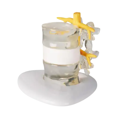 Modèle de simulation d'hernie discale Erler Zimmer