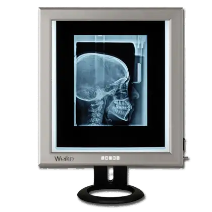 Négatoscope de bureau LED extra-plat avec interrupteur Weiko (1, 2, 3 Plages)