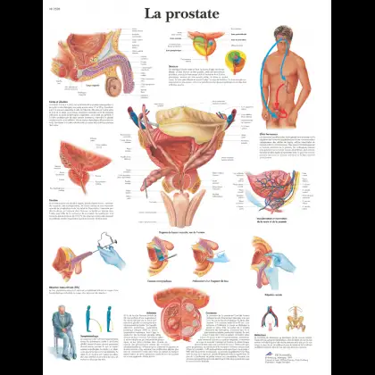Planche anatomique - La Prostate
