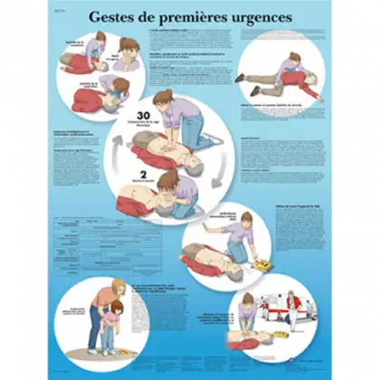 Planche anatomique - Les gestes de premières urgences