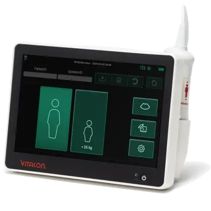 Bladder scanner / Scanner vésical portable VitaScan eVue