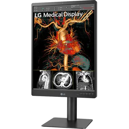 Moniteur d'affichage médical de diagnostic 3MP - 21" LG Electronics 21HQ513D