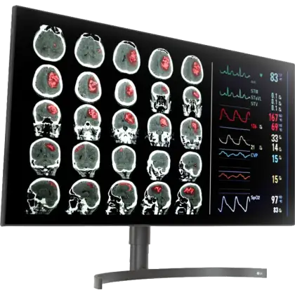 Moniteur d'affichage médical de diagnostic 8MP - 32" LG Electronics 32HL512D