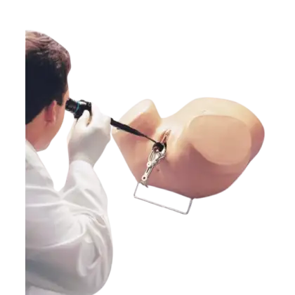 Simulateur d’Hystéroscopie Erler Zimmer